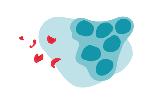 Die Illustration bildet die Autoimmunerkrankung HLH ab. Dabei zeigt sie eine Zelle in der sich mehrere Zellräume bilden. Die roten Blutkörperchen lösen sich durch die sogenannte Hämolyse auf.