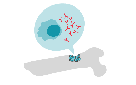 Die Illustration zeigt einen menschlichen Knochen und das Knochenmark. Innerhalb des Knochenmarkes vermehren sich Plasmazellen und fehlerhafte Antikörper unkontrolliert. Dadurch entsteht die Blutkrebsart Multiples Myelom.